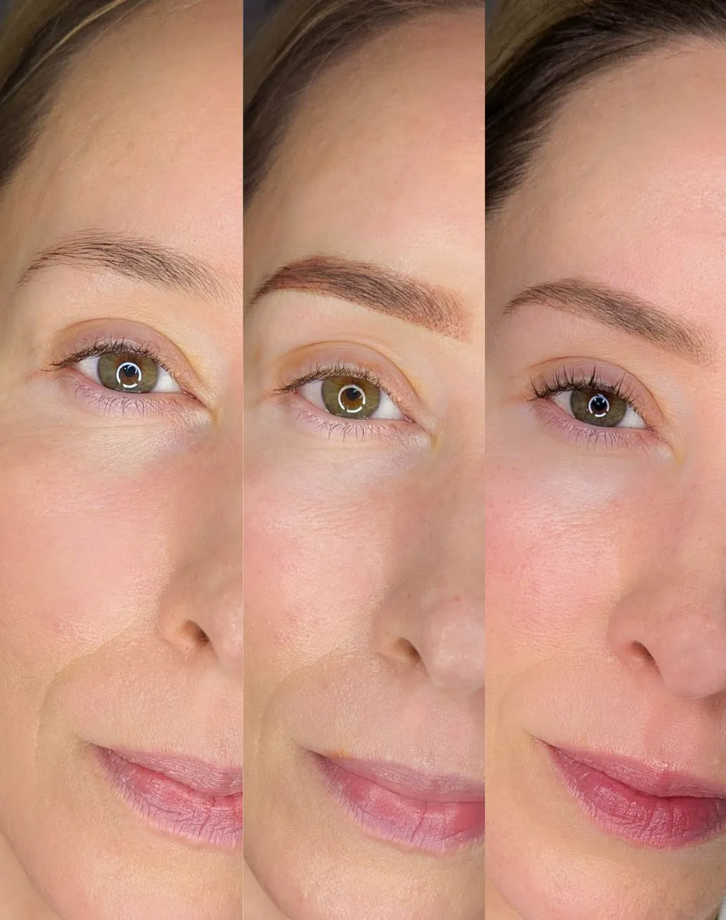 Results Vary by Skin Type